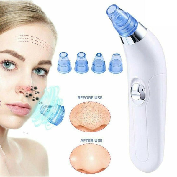 DERAM SUCTION